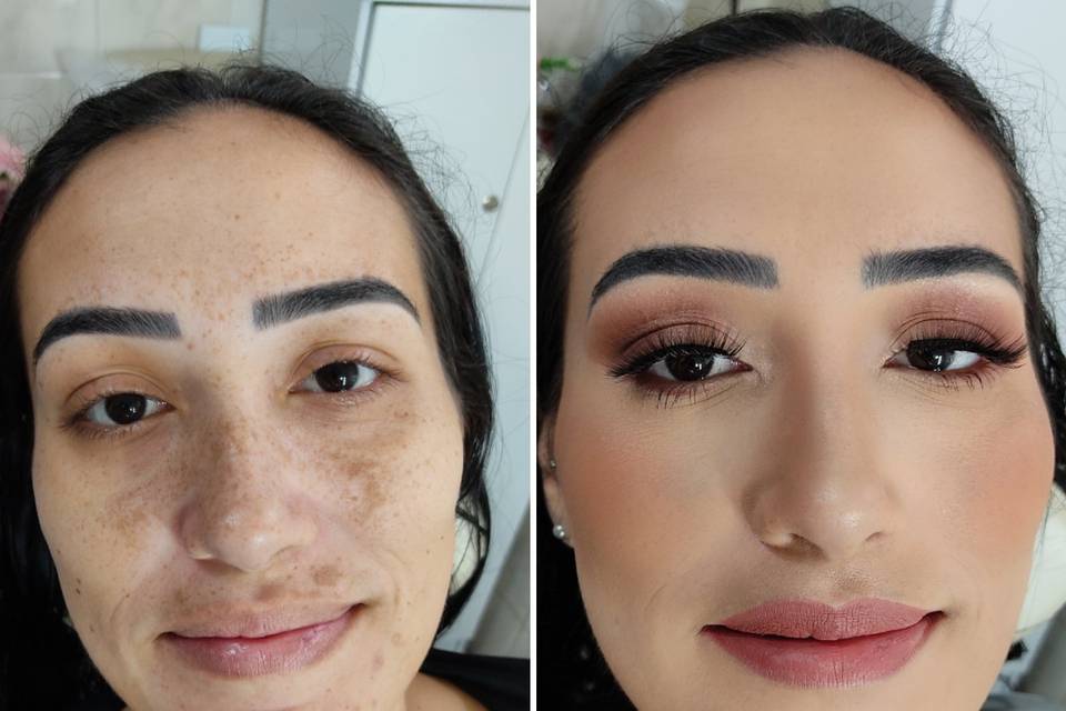 Cobertura de melasma