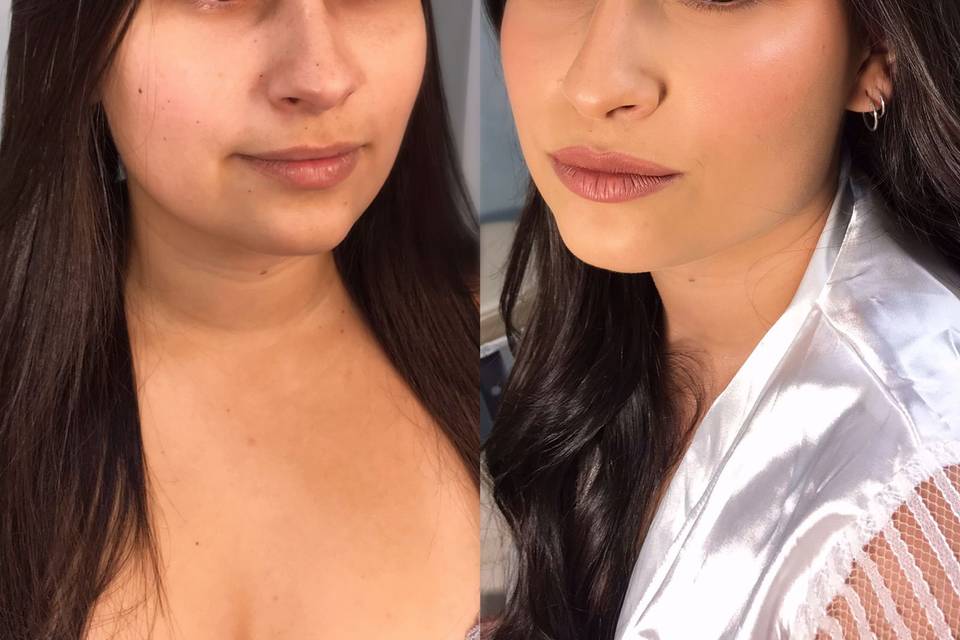 Antes e Depois