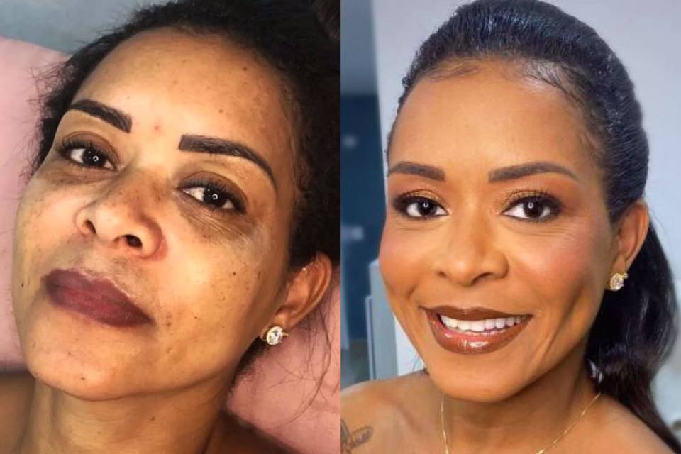 Antes e Depois