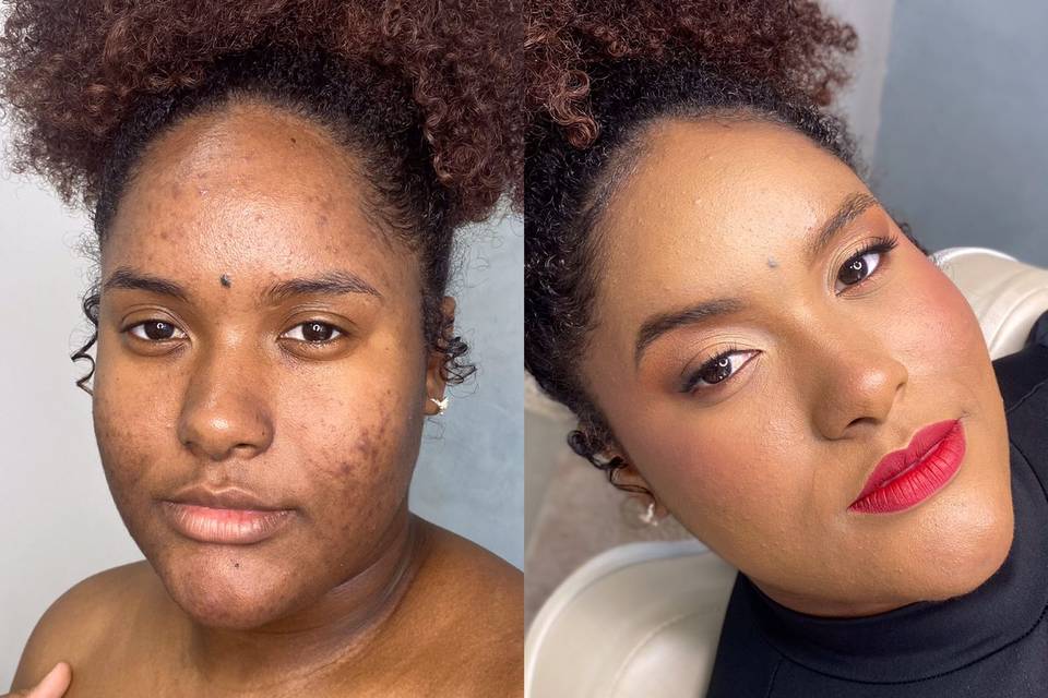 Antes e Depois