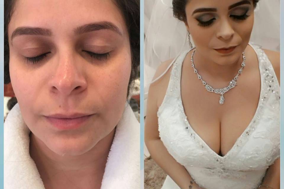 Antes e Depois da Fê