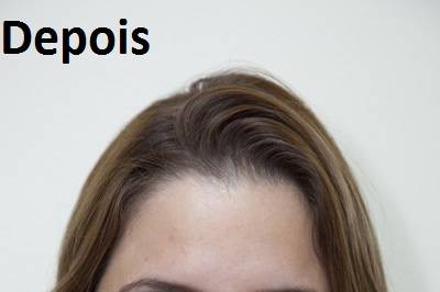 Make - Depois