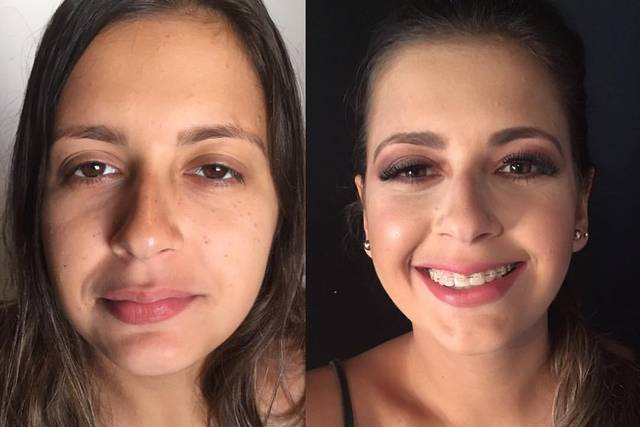 Antes e Depois