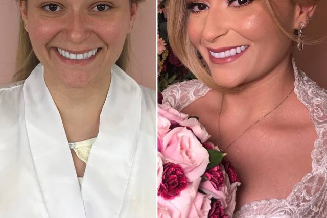 Antes depois noiva j