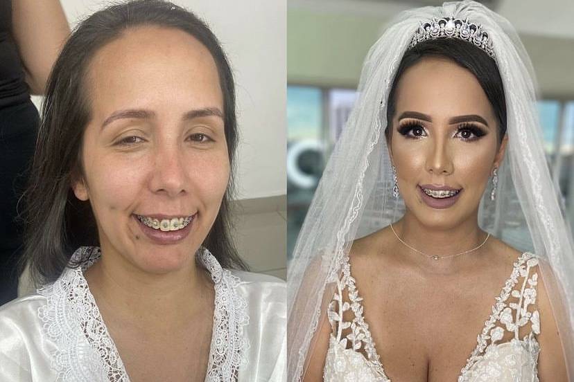 Antes e depois noivinha