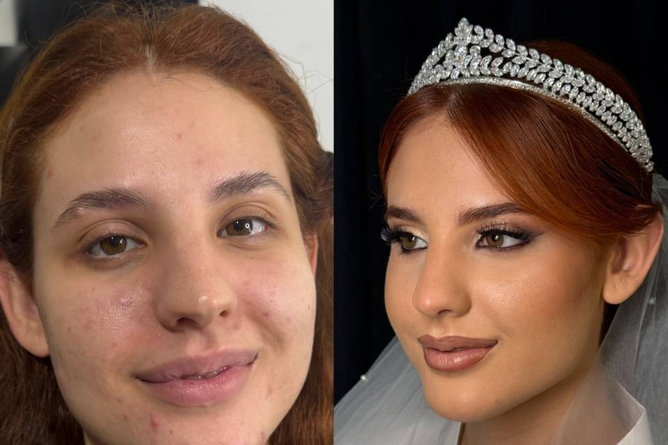 Antes e depois