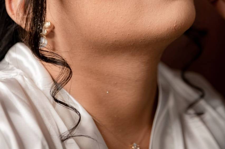 Detalhe