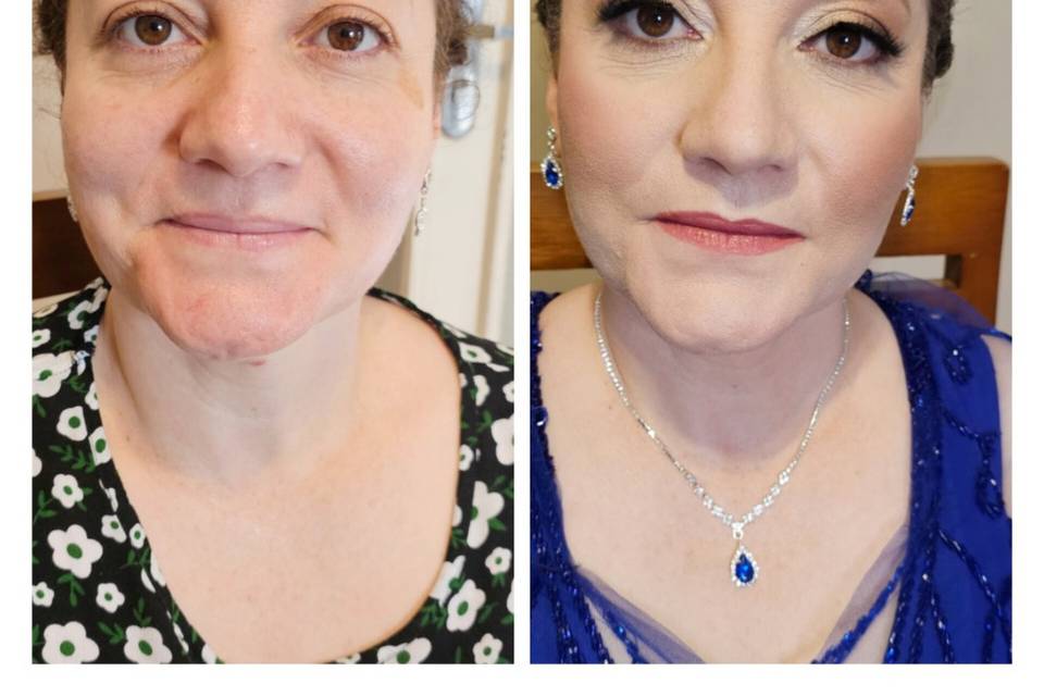 Antes e depois
