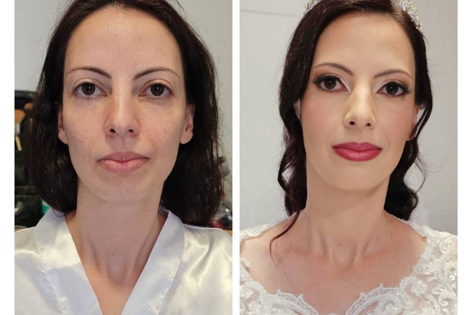 Antes e depois