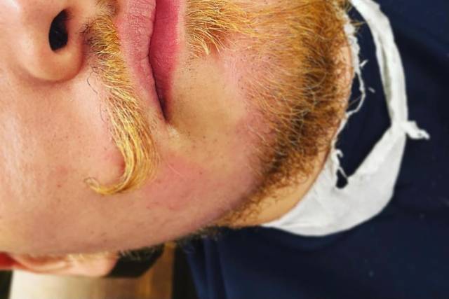 Mustache