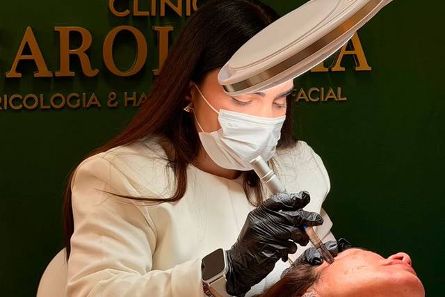 Microagulhamento Facial