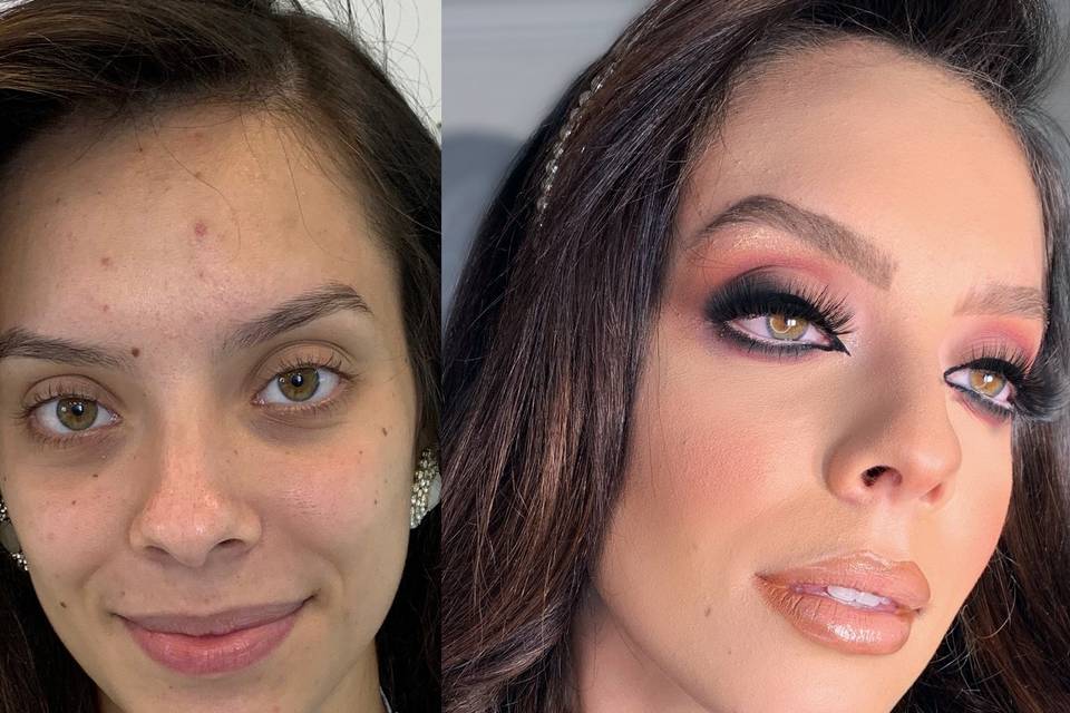 Antes e depois