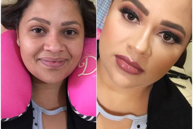 Antes e depois