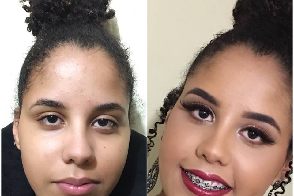 Antes e depois