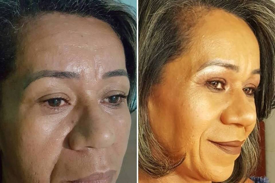 Antes e Depois