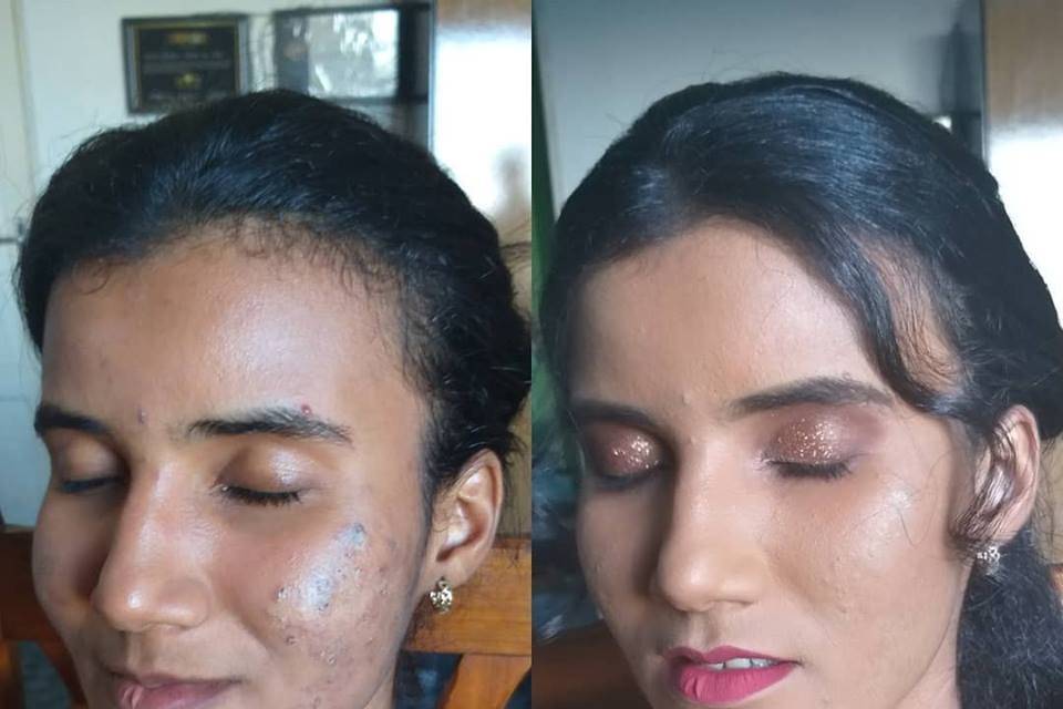 Antes e Depois