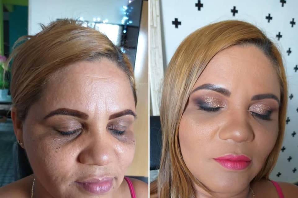 Antes e Depois, olheiras