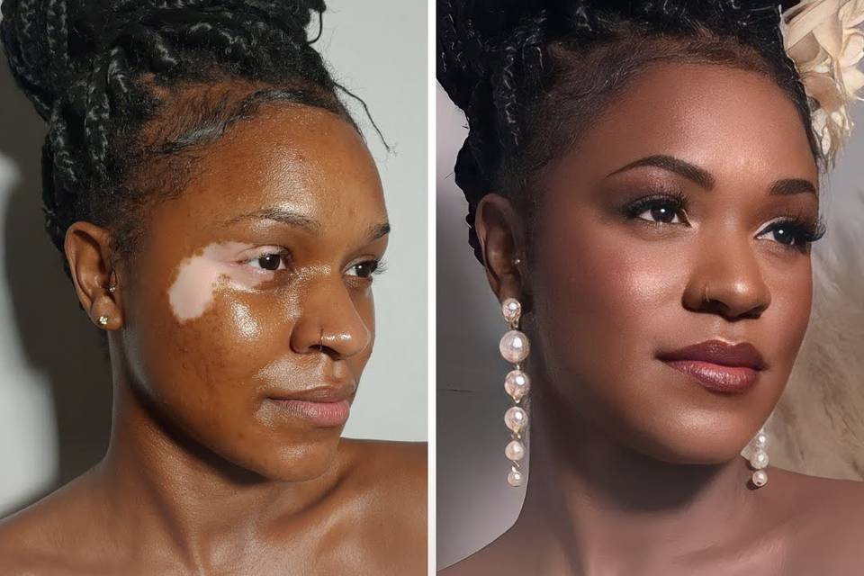 Antes e Depois