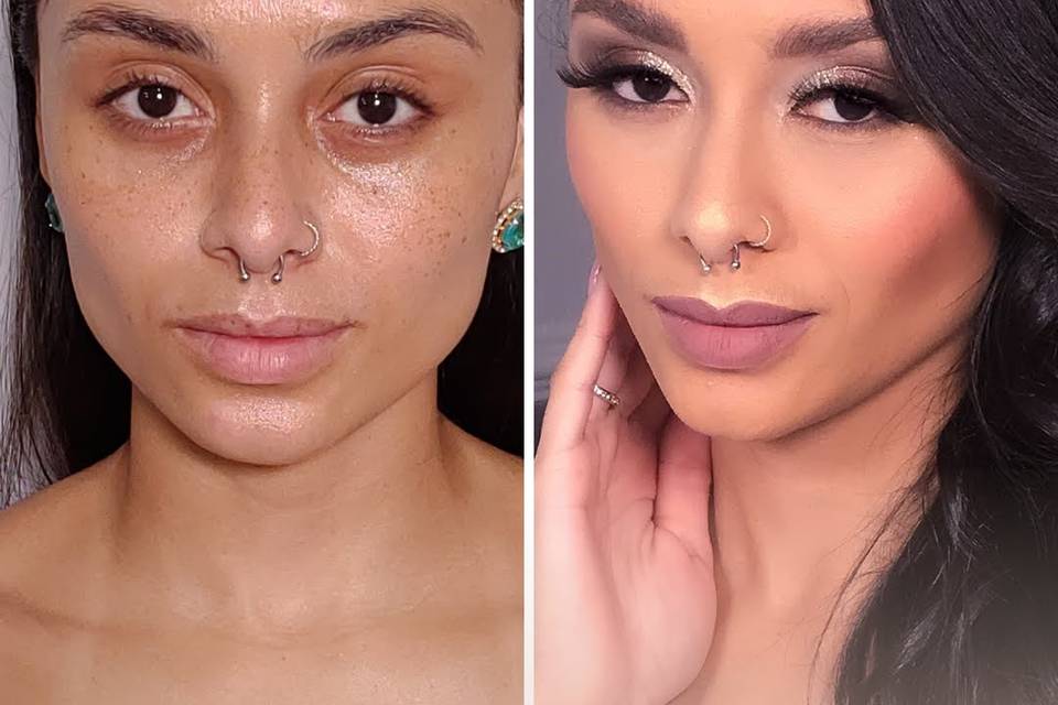 Antes e Depois