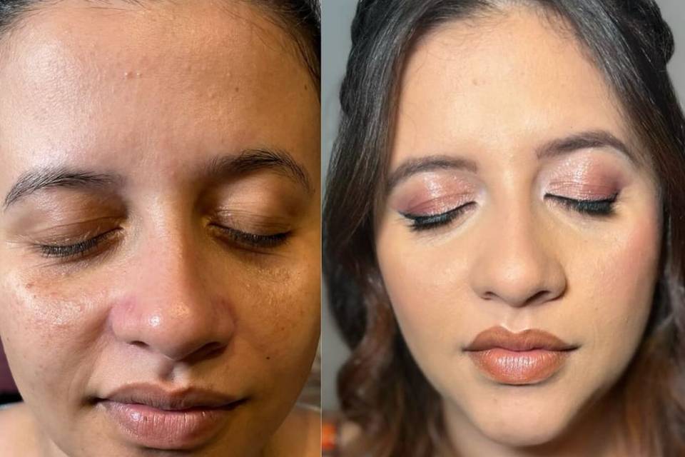Antes e depois