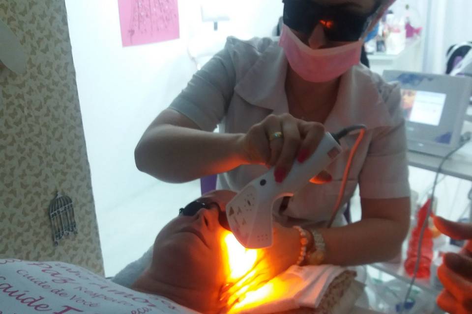 Aplicação de laserterapia