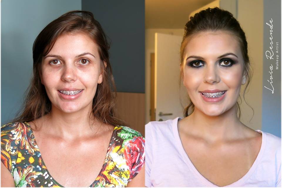 Antes e depois