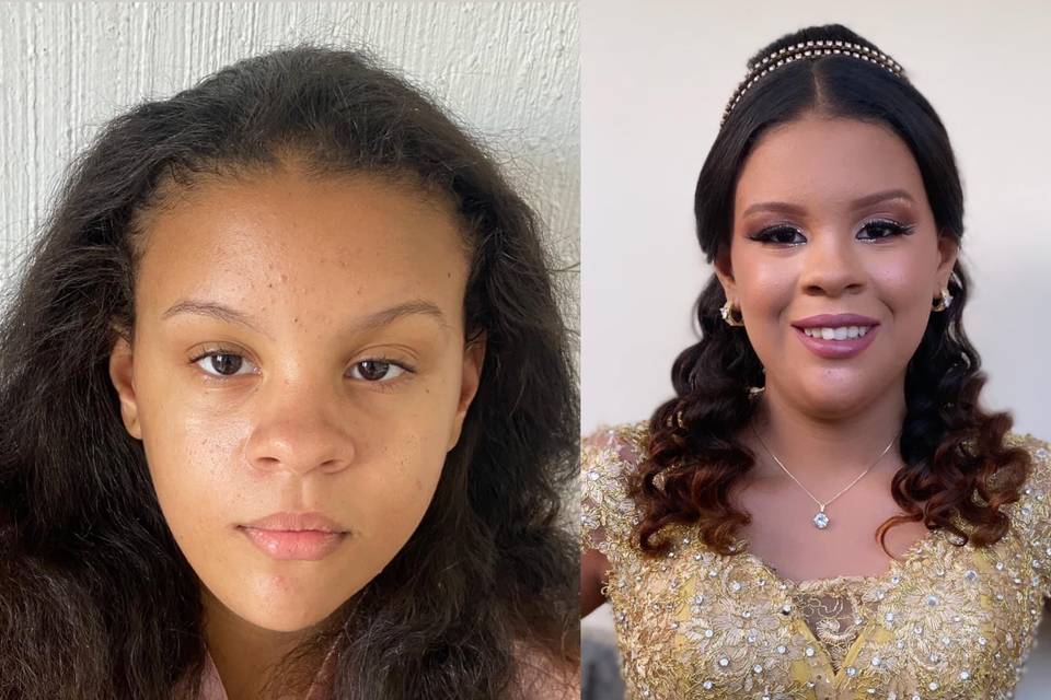 Antes e depois dessa linda