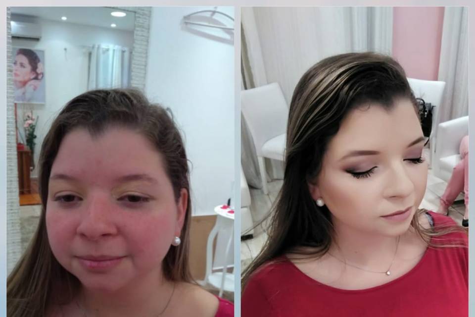 Antes e Depois