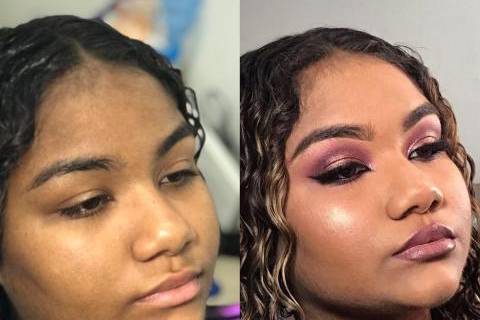 Antes e depois