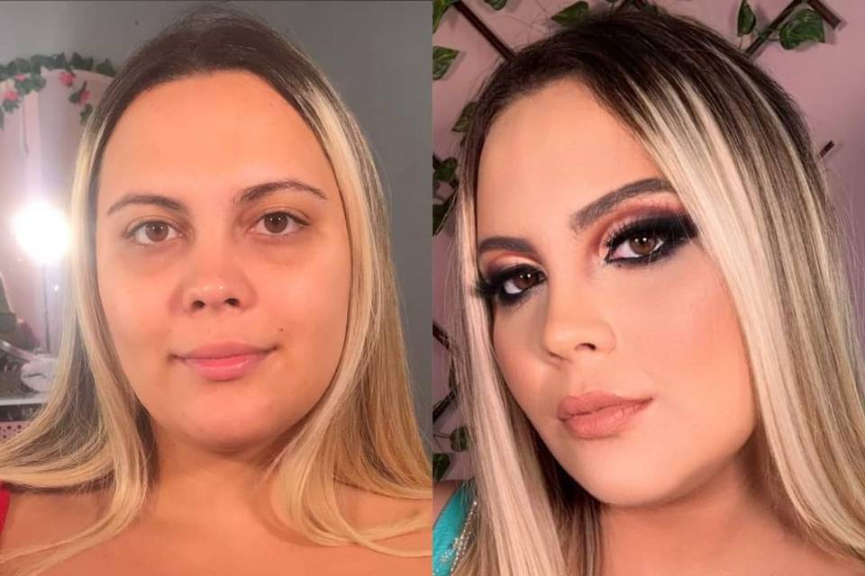 Antes X Depois